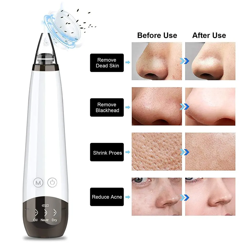 

Blackhead Cleaner Multifunctional Facial Cleaner With 6 Suction Probes Microcrystalline Blackhead Instrument hot product