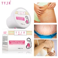 35g effectively repair stretch marks removal remover plant natural heal pregnancy breast hip legs stretch mark cream