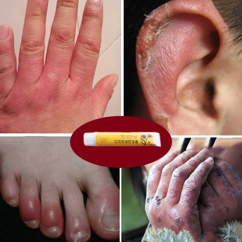 Крем от трещин на ногах морщин|Инструмент для ухода за ступнями| |