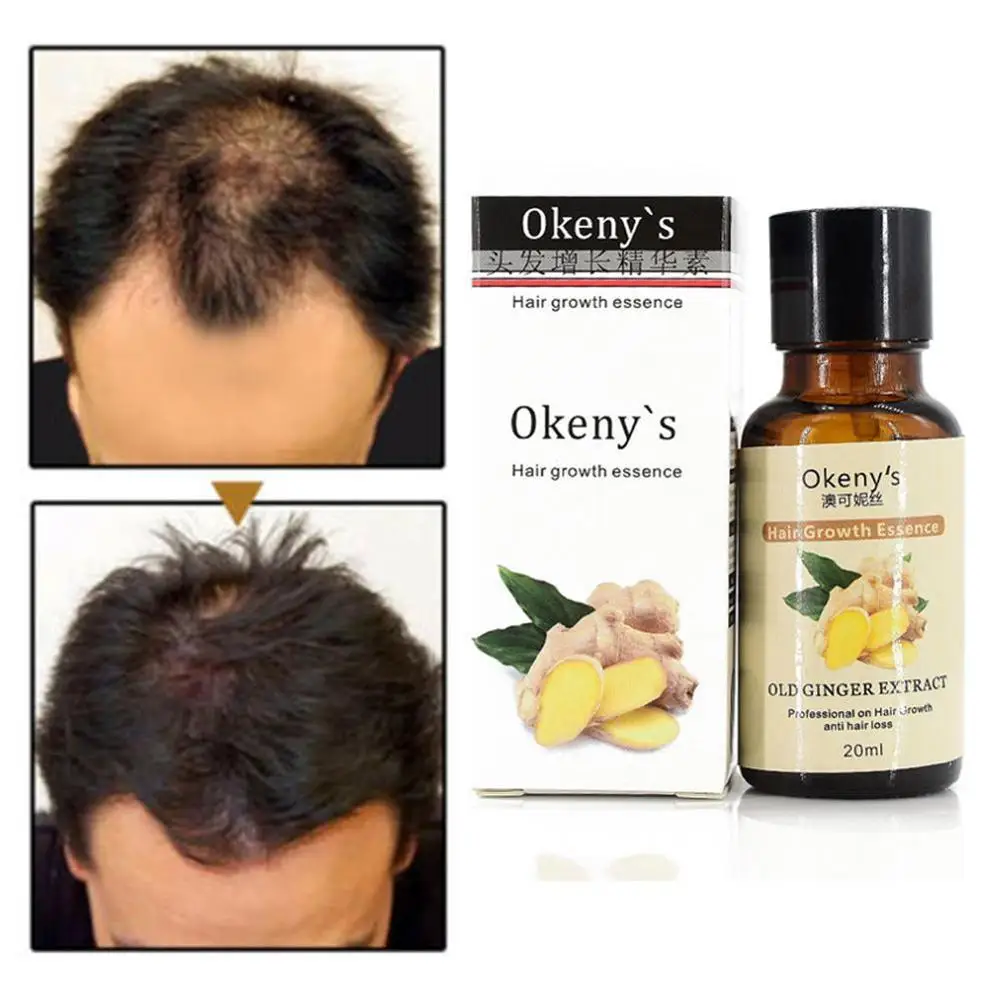 Hair Growth Loss Liquid 20ml Dense 1 Bottle Fast Organic Grow Restoration Pilatory | Красота и здоровье