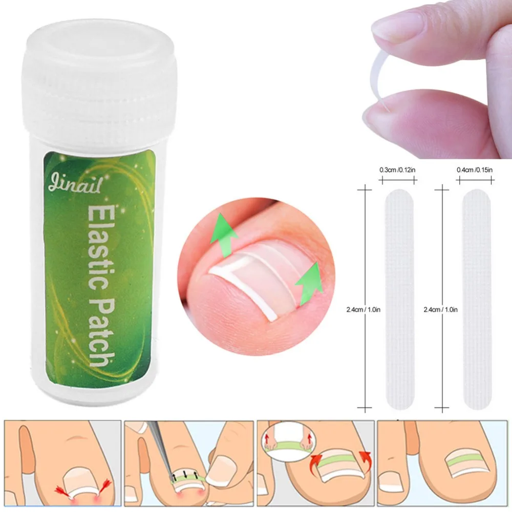 10 шт. инструмент для педикюра вросших ног зажим выпрямления изогнутый фиксатор