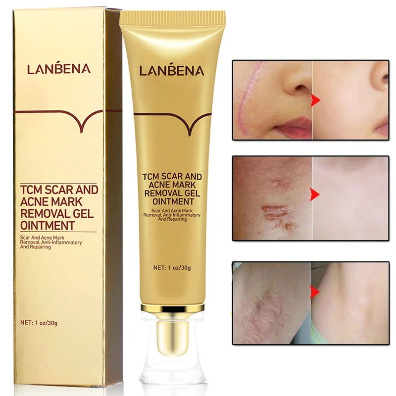Крем для удаления шрамов от акне 30 г крем лица гель восстановления контроль