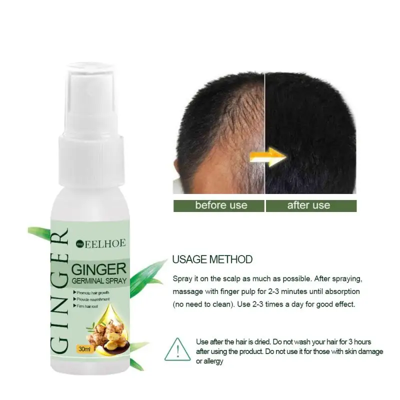 Лосьон для роста волос Ginger лосьон интенсивный Спрей Против выпадения лечение