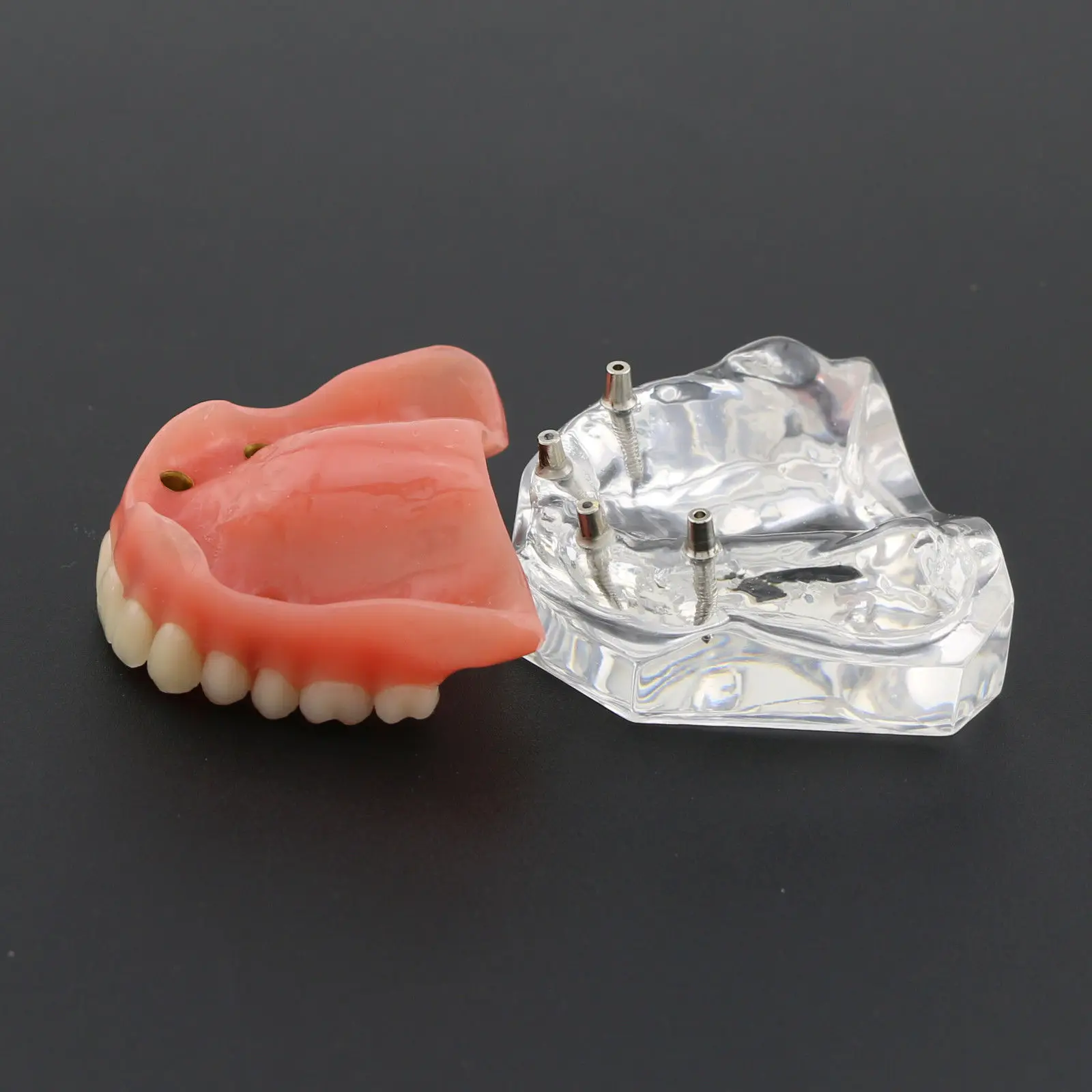 1 шт./упак. Dental Upper Overdenture Superior 4 имплантаты демо модель 6001 02