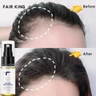Светлые королевские продукты для роста волос, эфирное масло, жидкое лечение, предотвращающее выпадение волос, уход за волосами