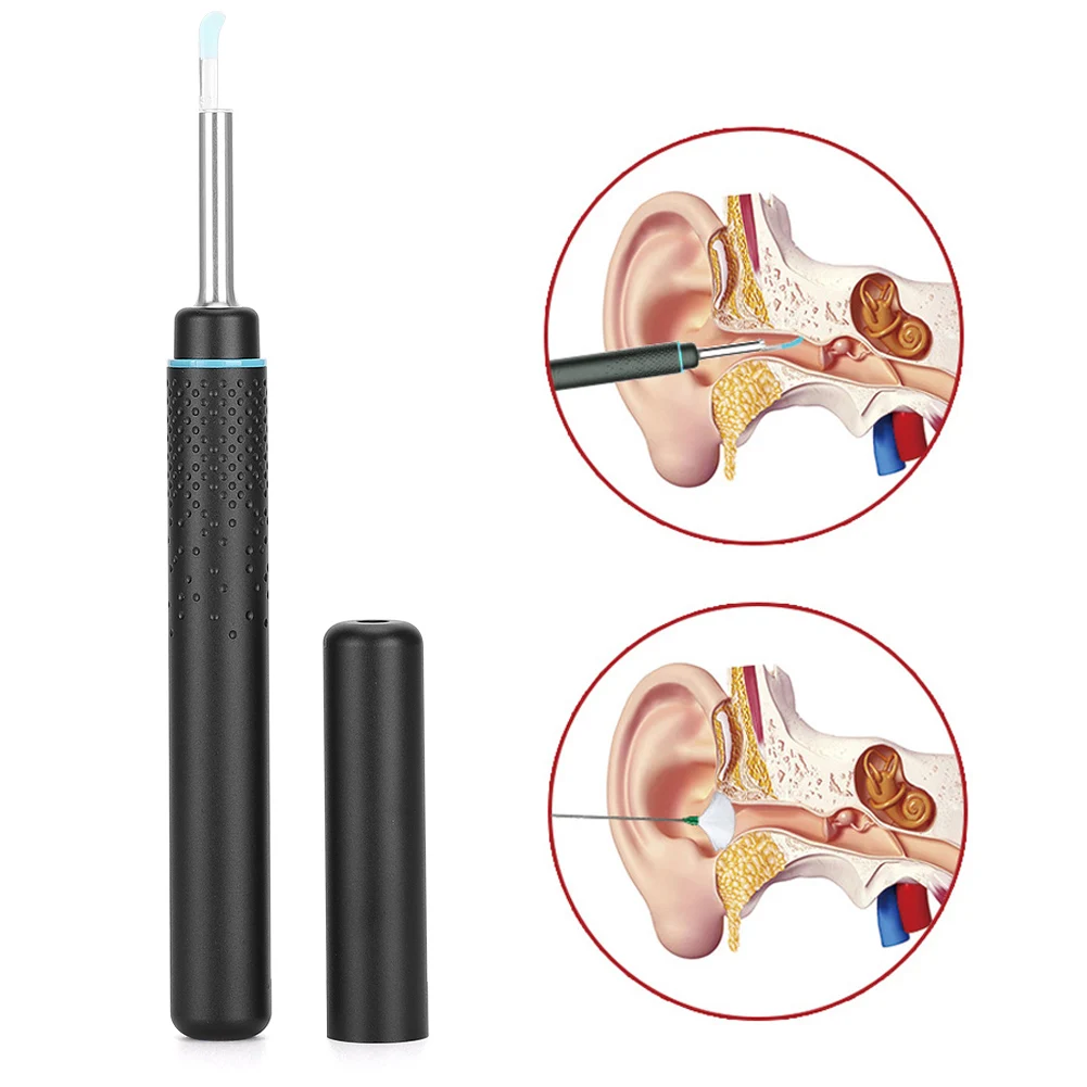 

Умный ушной вкладыш, высокоточный эндоскоп, черный отоскоп, Бороскоп, устройство для чистки ушей, инструменты для уборки