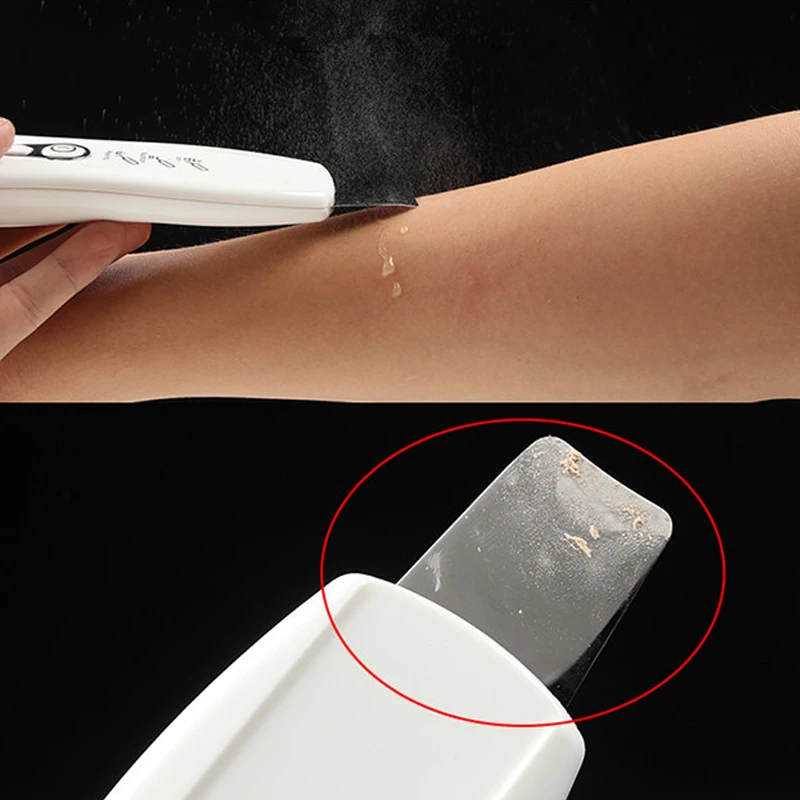 Ultrasonic Skin Scrubber Facial Deep Cleansing Pore Peeling Blackhead Removal Dead Extractor Face Cleanser |