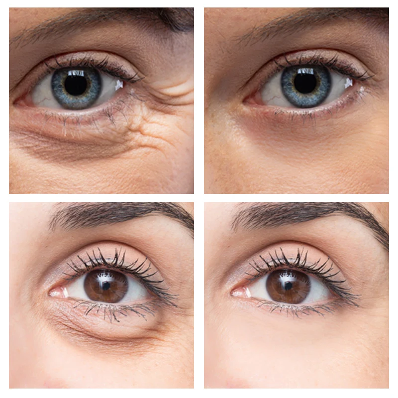 Eye Cream for Dark Circles Bags Fine Lines Anti-Wrinkles Lifting and Firming All Skins |