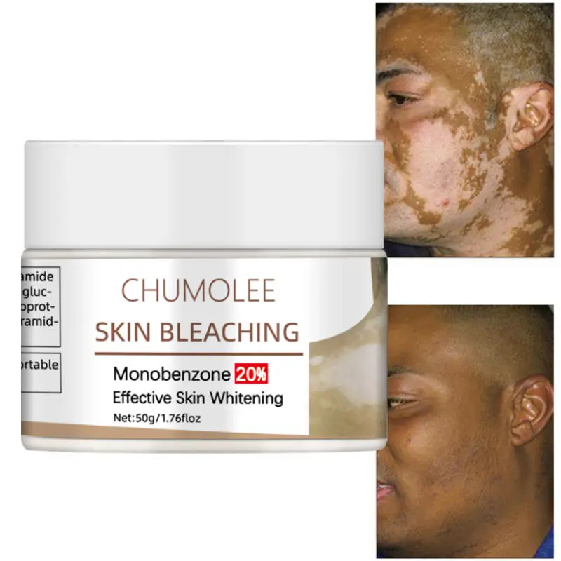 Chumolee монобензон 20% кожей Отбеливающий для лица отбеливающий крем белое пятно