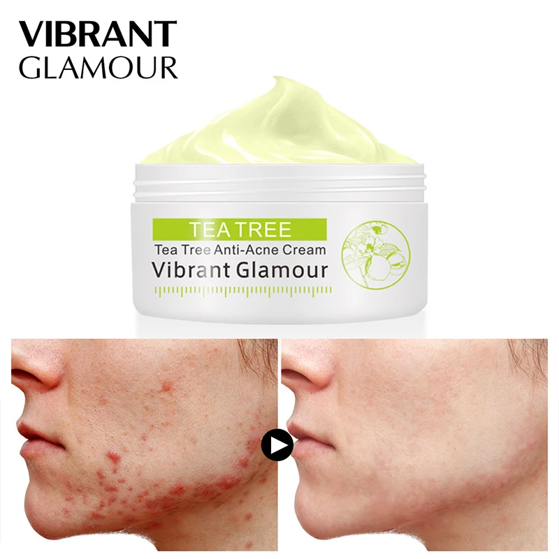 

VIBRANT GLAMOUR LANBENA Wrinkle Face Cream Acne Treatment Moisturizing Neck Firming Cream Deeply Repair Whitening Skin Care