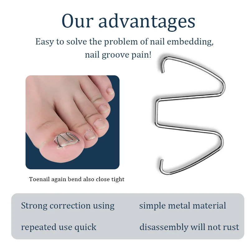 Orthodontic correction of nails and in the meat | Красота и здоровье