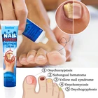 Крем для удаления грибка ногтей, мазь 20 г, онихомикоз, лечение грибковых ногтей, лечение инфекций, лечение паронихии, пальцев ног, Уход за ногтями