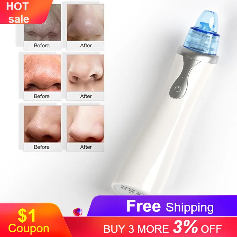 Вакуумный аппарат для глубокой очистки лица чистки с ЖК экраном и зарядкой от