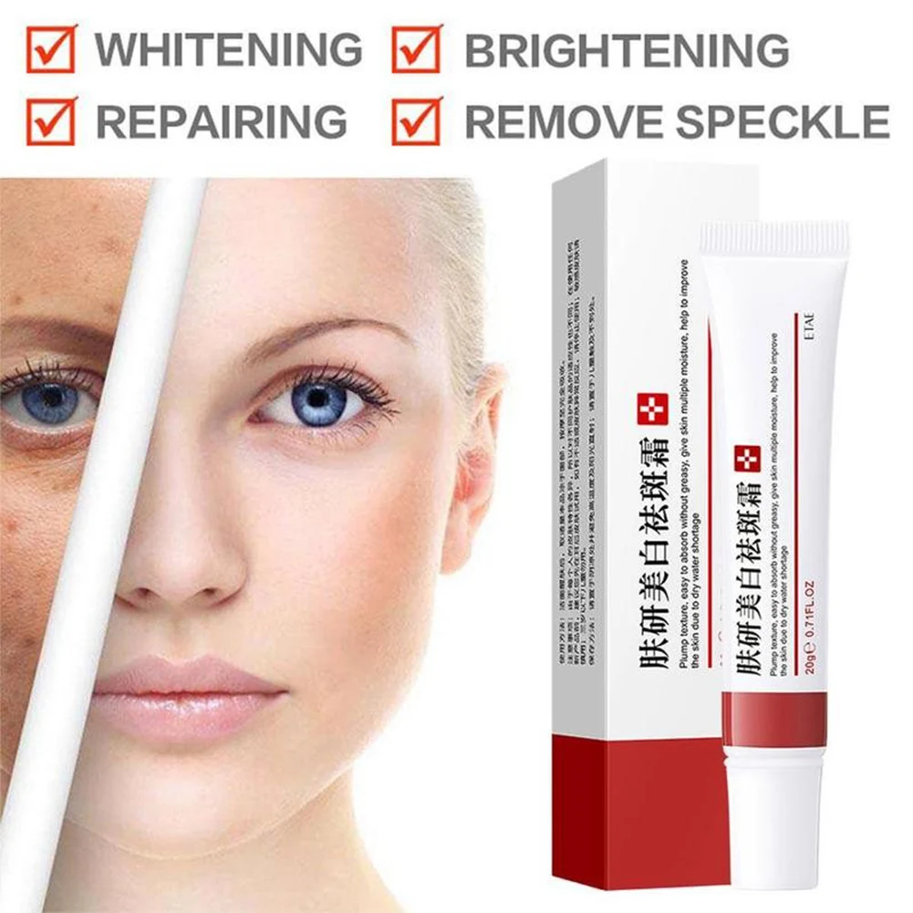

Effective Whitening Freckle Cream Remove Melasma Acne Spot Pigment Melanin Dark Spots Pigmentation Moisturizing Gel Skin Care