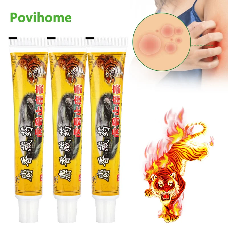 

1/3pcs Tiger Balm Psoriasis Cream Dermatitis Eczematoid Eczema Ointment Treatment Relieve Various Skin Problem Ointment 20g