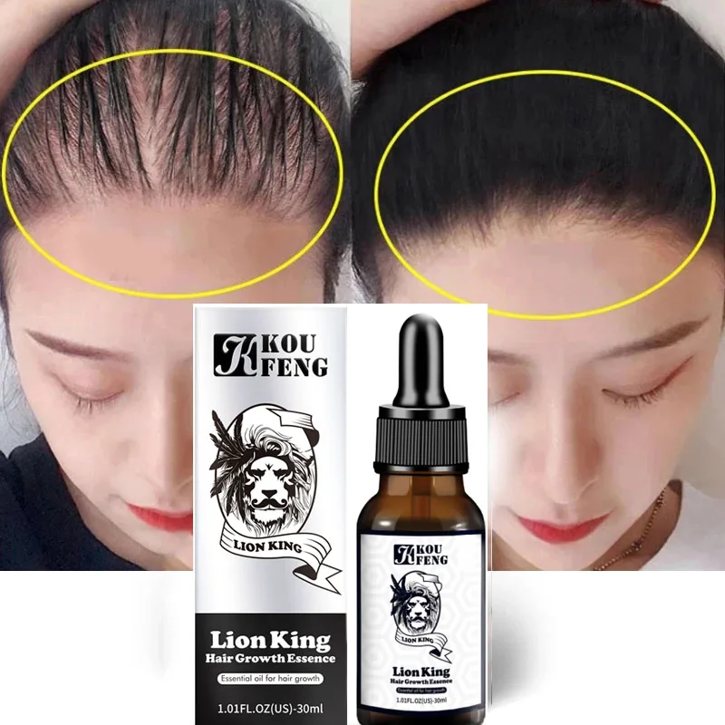 

2021 Hot Fast Wild Growth Hair Serum Oil Treatment for Hair Loss Natural Essence for Men Women EXTREME REPAIR For Bald spots