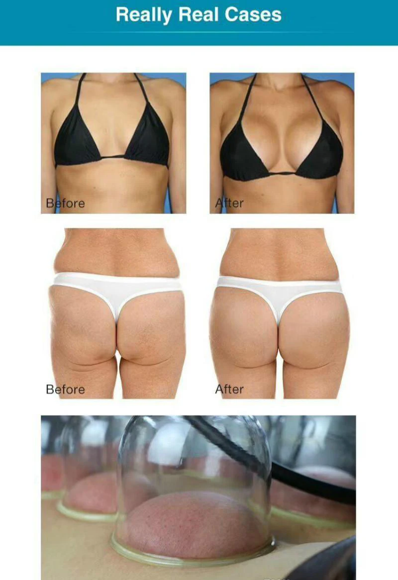 HOT SALE!!! Breast Enlargement Body shaping Vacuum Massage Therapy With Cellulite Removal Machine For Salon | Красота и здоровье