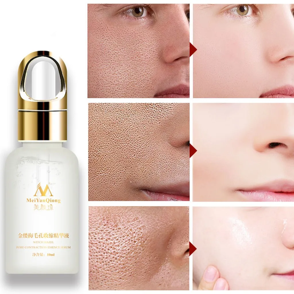 Сыворотка для лица средство удаления черных точек маска уменьшения пор лечение