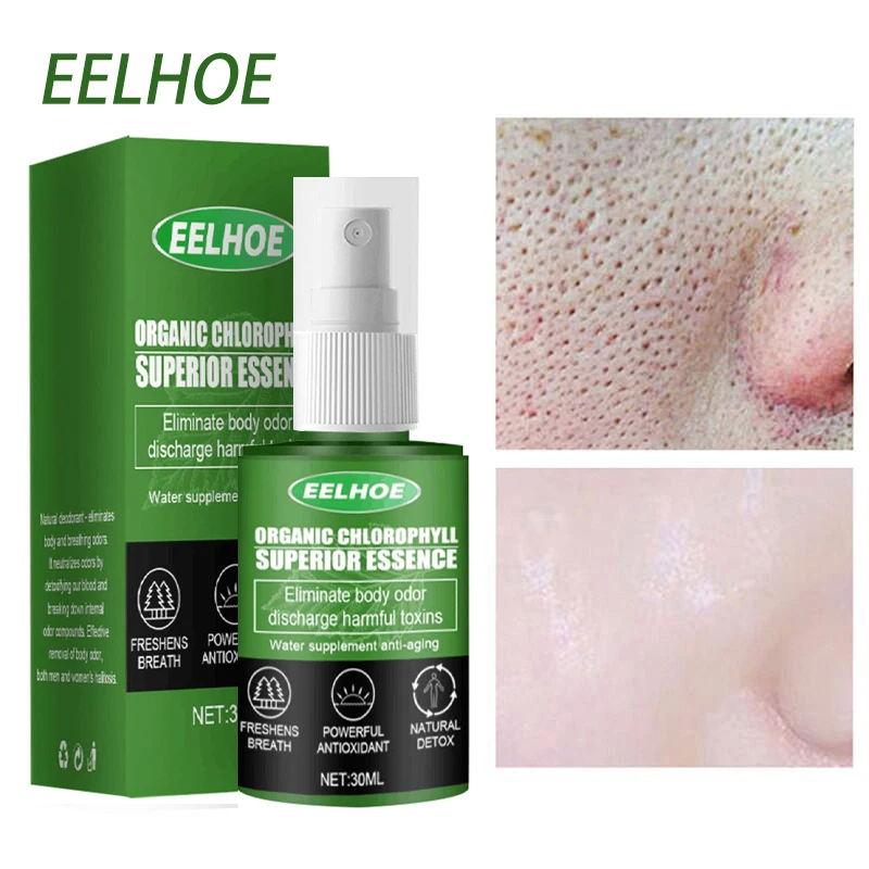 Хлорофилл уменьшает поры сыворотка для лица натуральная детоксикация против