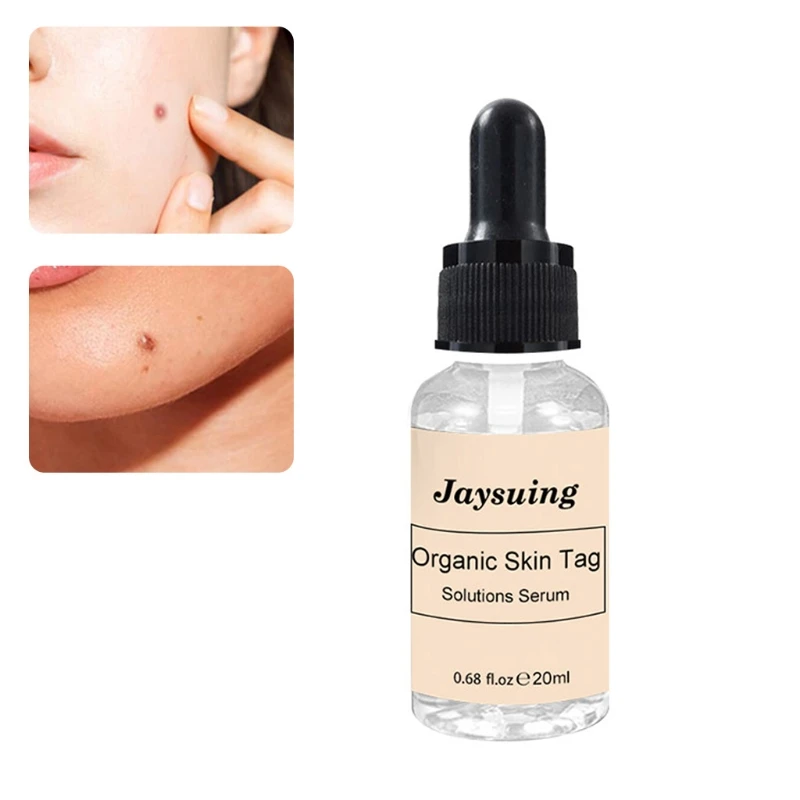 

Новинка 2021, Органическая Сыворотка для раствора кожи 20 мл, безболезненные этикетки, масло для удаления родинок и веснушек