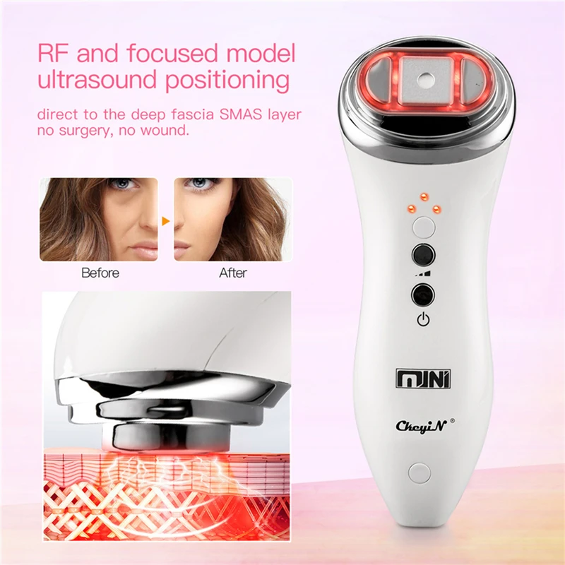 Goede Mini Hifu Facial Machine Ultrasone Gezicht Lifting Aanscherping Anti Aging Rimpels Toning Huidverjonging Schoonheid Apparaat Stimulator