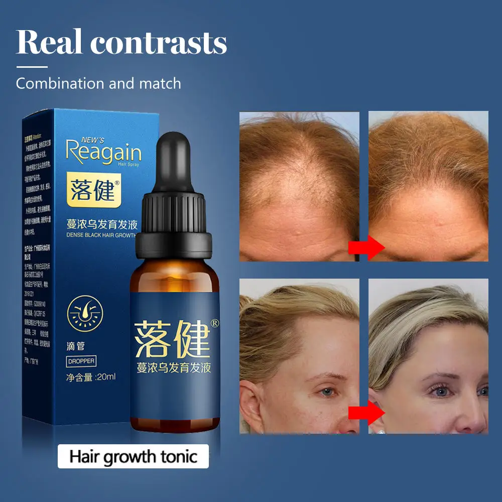 

Hair Growth Essence Oil Anti Hair Loss Products for Hair Growth Treatment Natural Hair Serum Thickener Hair Care Solutions