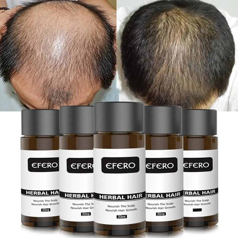 

Powerful Hair Growth Serum Prevent Hair Loss Essential Oil Longer Thicker Prevent Baldness Products Professional Hair Grow