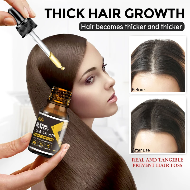 

Hair Growth 5% Minoxidil Essence Oil Spray for Hair Regrowth Oil Anti Hair Loss Hair Growth Serum Hair Loss Treatment Hair Tonic