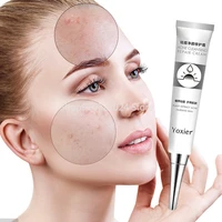 acne treatment blackhead remova anti acne cream whitening shrink pores face care acne scar remove oil control skin care