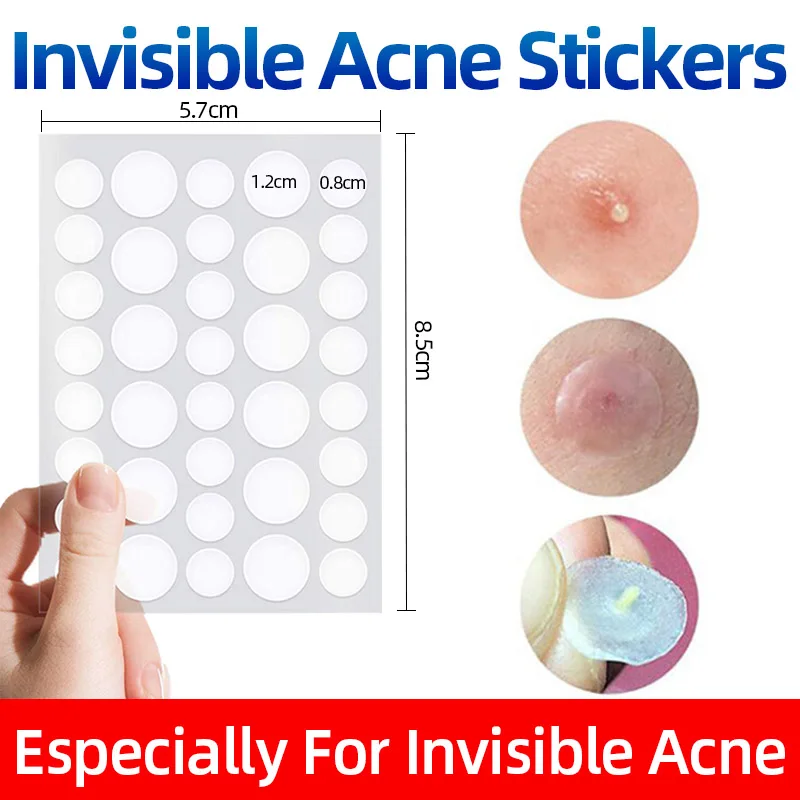 

Комплект из 2 предметов удалить Патчи от акне Невидимый прыщей наклейки улучшить черных точек шрамов Знаки Ремонт по уходу за кожей Красота ...