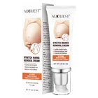 Крем Для Удаления растяжек для беременных, растяжки крем для удаления шрамов, для укрепления белой кожи, уход за телом