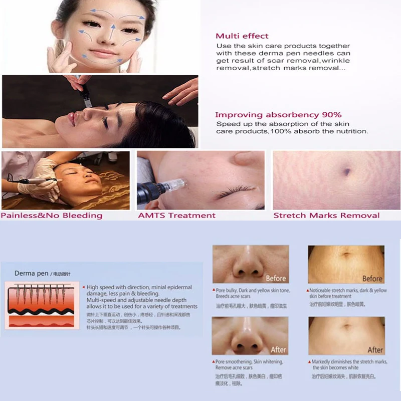 

9/12/24/36/nano Needle Cartridge Bayonet for Tattoo Dr.pen A1 Derma Pen A6 Permanent Makeup Machine Tattoo Cartridge Microneedle