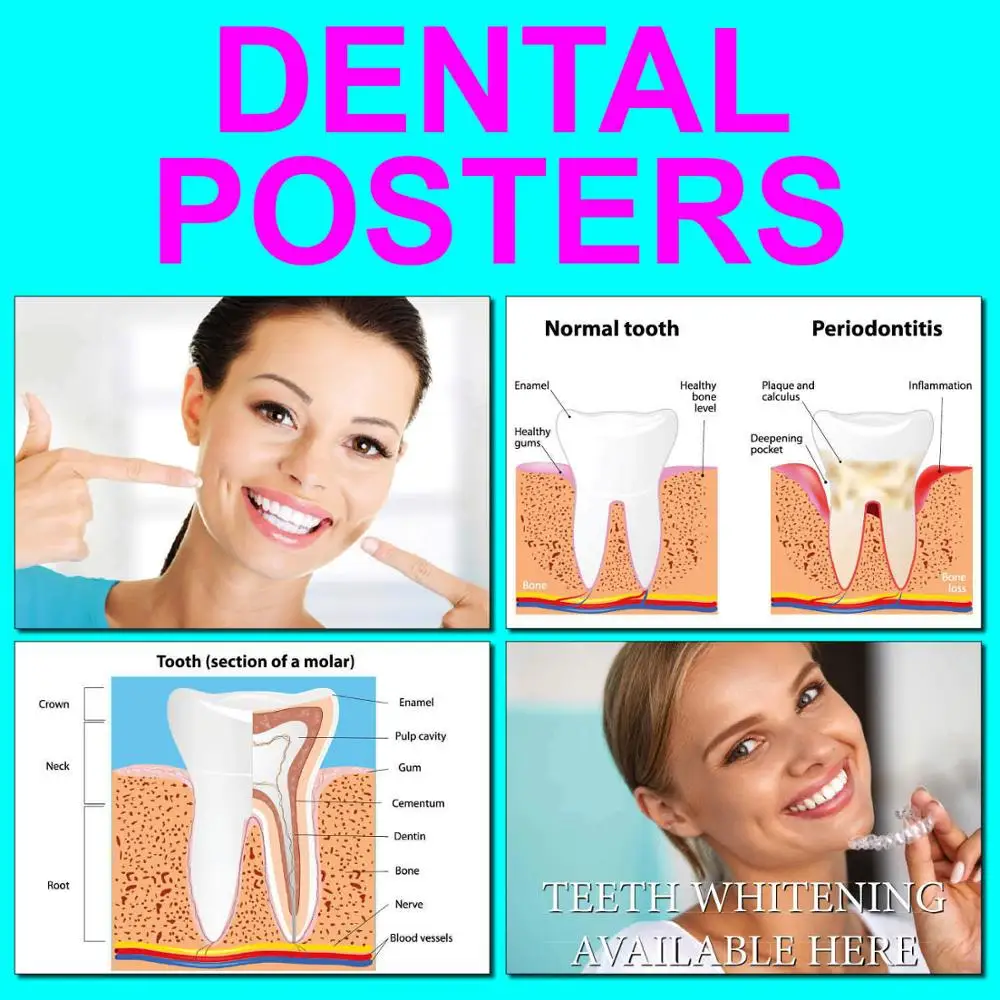 

8Style Choose DENTAL GUM DISEASE & TEETH WHITENING Art Film Print Silk Poster Home Wall Decor 24x36inch