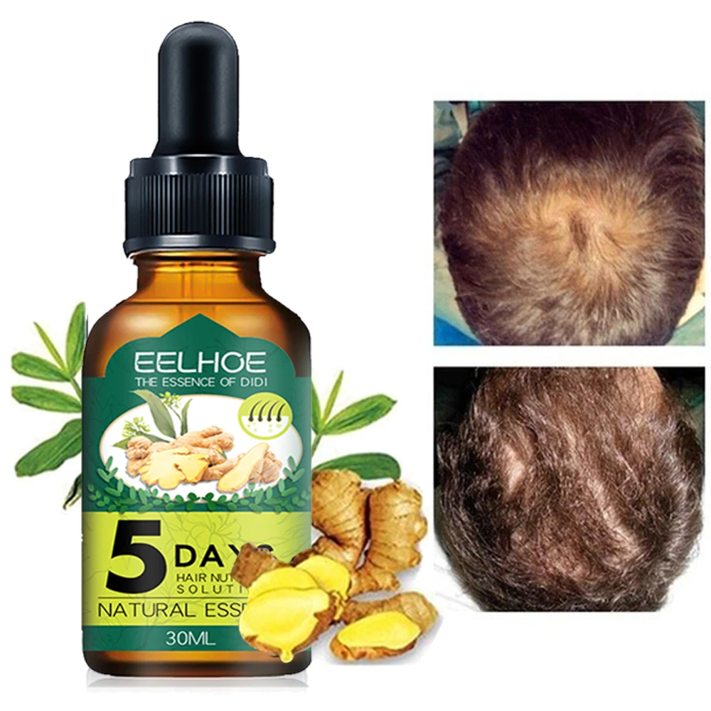 Эссенция для роста волос масло продукты быстрого уход за кожей головы лечение