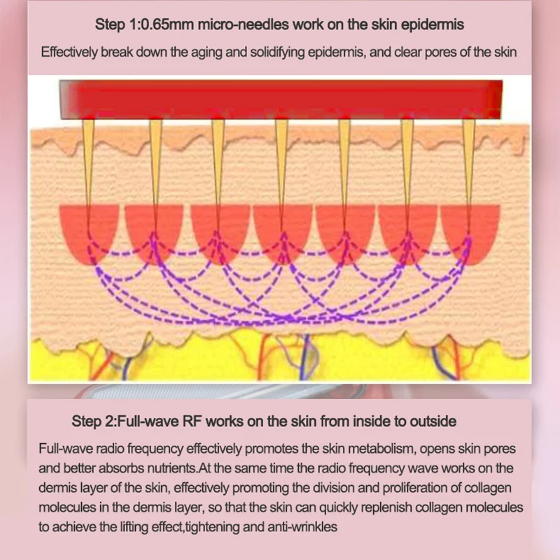 Goedkoop Bb Look Microstroom Apparaat Gezicht Lifting Draai Rimpel Verwijdering Schoonheid Instrument Radio Frequentie Huid Aanscherping Massager
