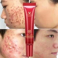 effective acne removal cream herbal anti acne repair fade acne spots oil control whitening moisturizing face gel skin care 15g