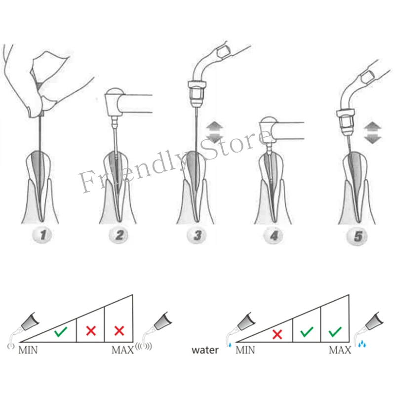 3 шт. стоматологическое оборудование E1 эндонтический наконечник для EMS и Woodpecker