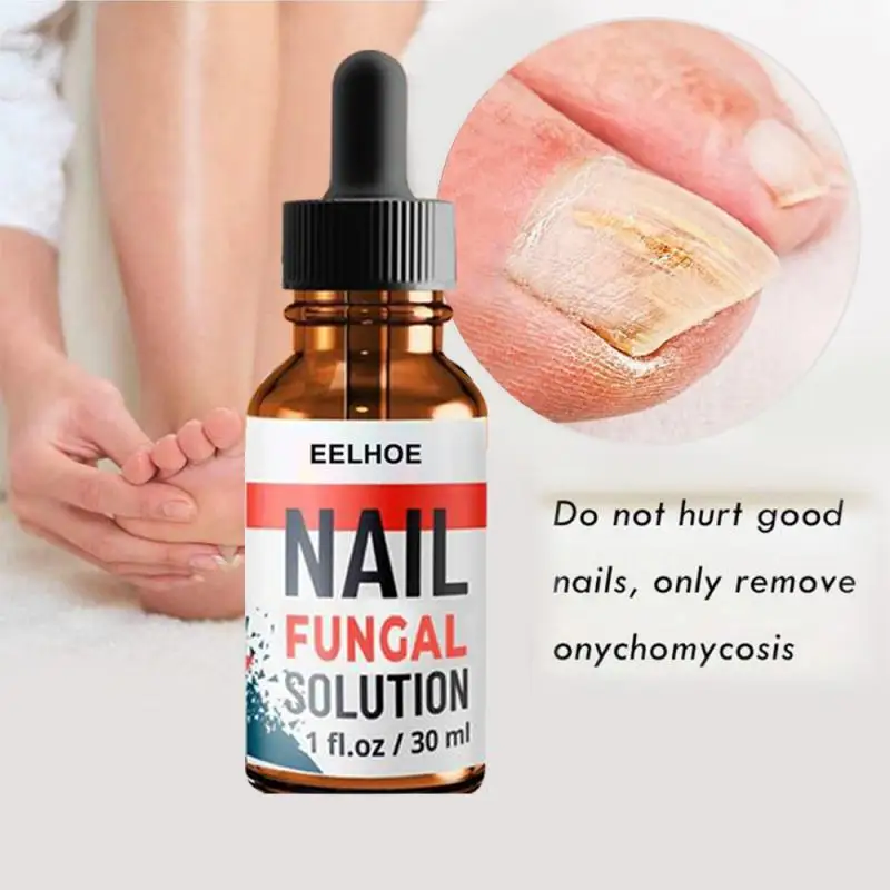 

10/20/30ml Foot Anti-fungal Remove Onychomycosis Repair Liquid Healthy Nail Care Repair Liquid Nails Care Antifungal TSLM1
