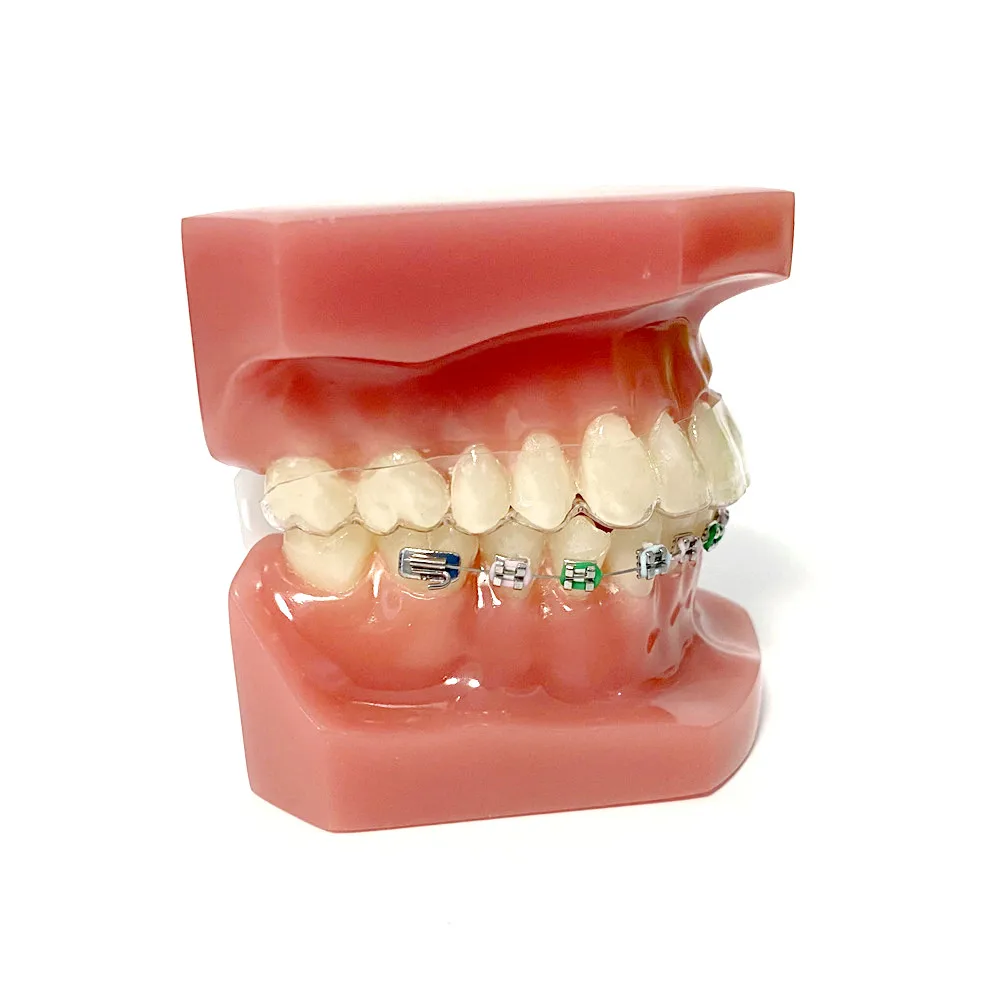 1 ~ 10 шт. невидимые металлические кронштейны высокого качества