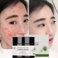 acne treatment face cream 30g remove melasma acne spots pigment melanin dark spots blackhead repair herbal skin care cosmetics