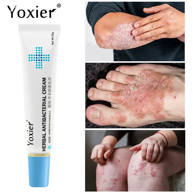 

3 шт., антибактериальный крем Yoxier с экземой, против зуда