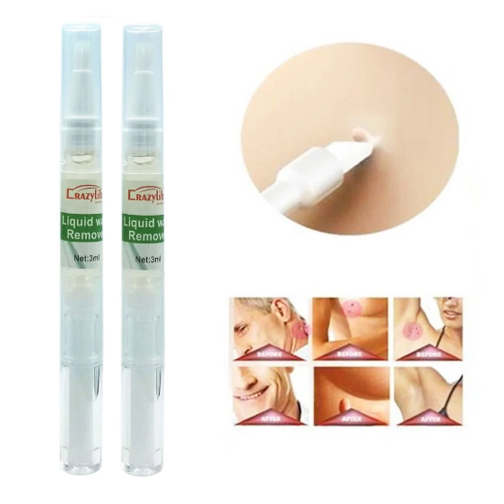 Ручка для удаления шкуры 1 шт. 3 мл|Пластыри терапевтические| |