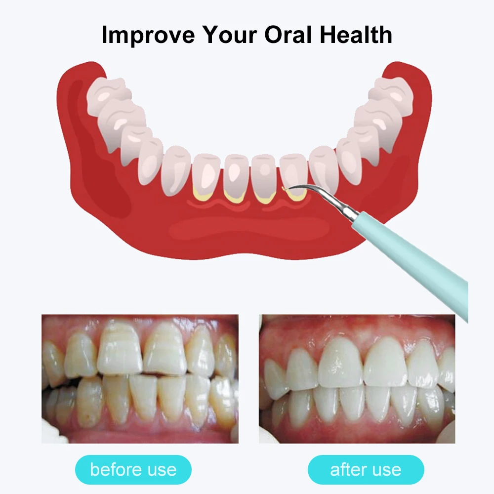 Портативный электрический умный подсчет для стоматологического подсчета