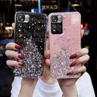 Мягкий блестящий чехол со звездами для Xiaomi mi Poco M4 Pro X3 GT NFC M3 Redmi Note 11 10 Pro 11T 10S REDMi Note10 Pro