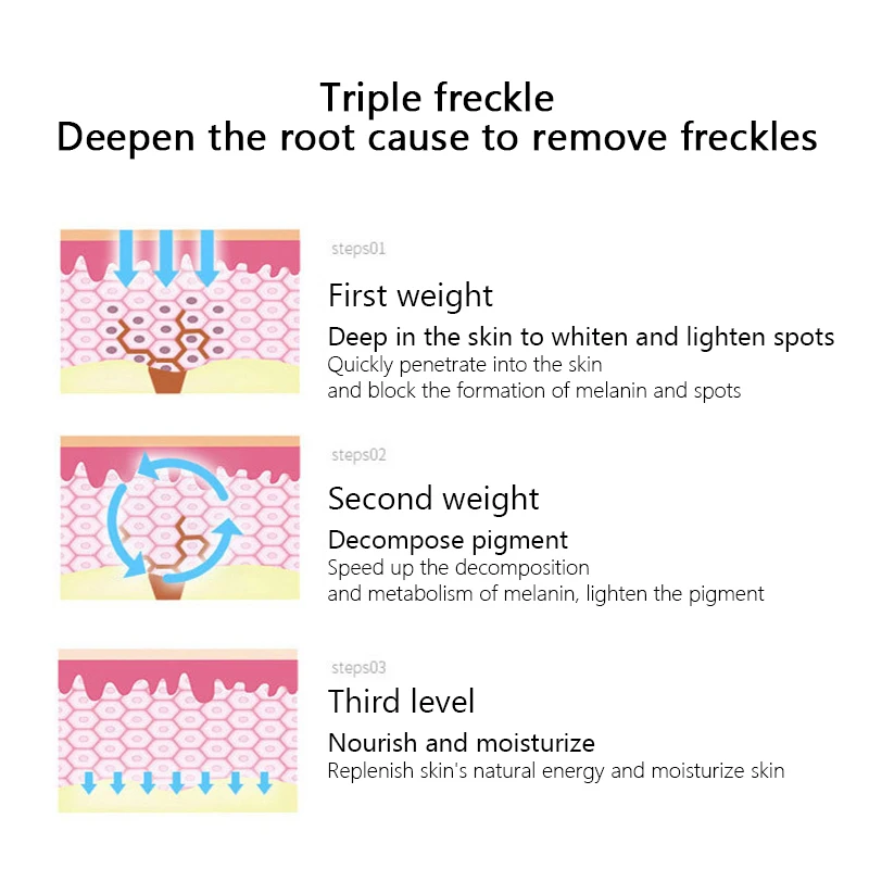 

Effective Whitening Freckle Cream Remove Melasma Acne Spot Pigment Melanin Dark Spots Pigmentation Moisturizing Gel Skin Care