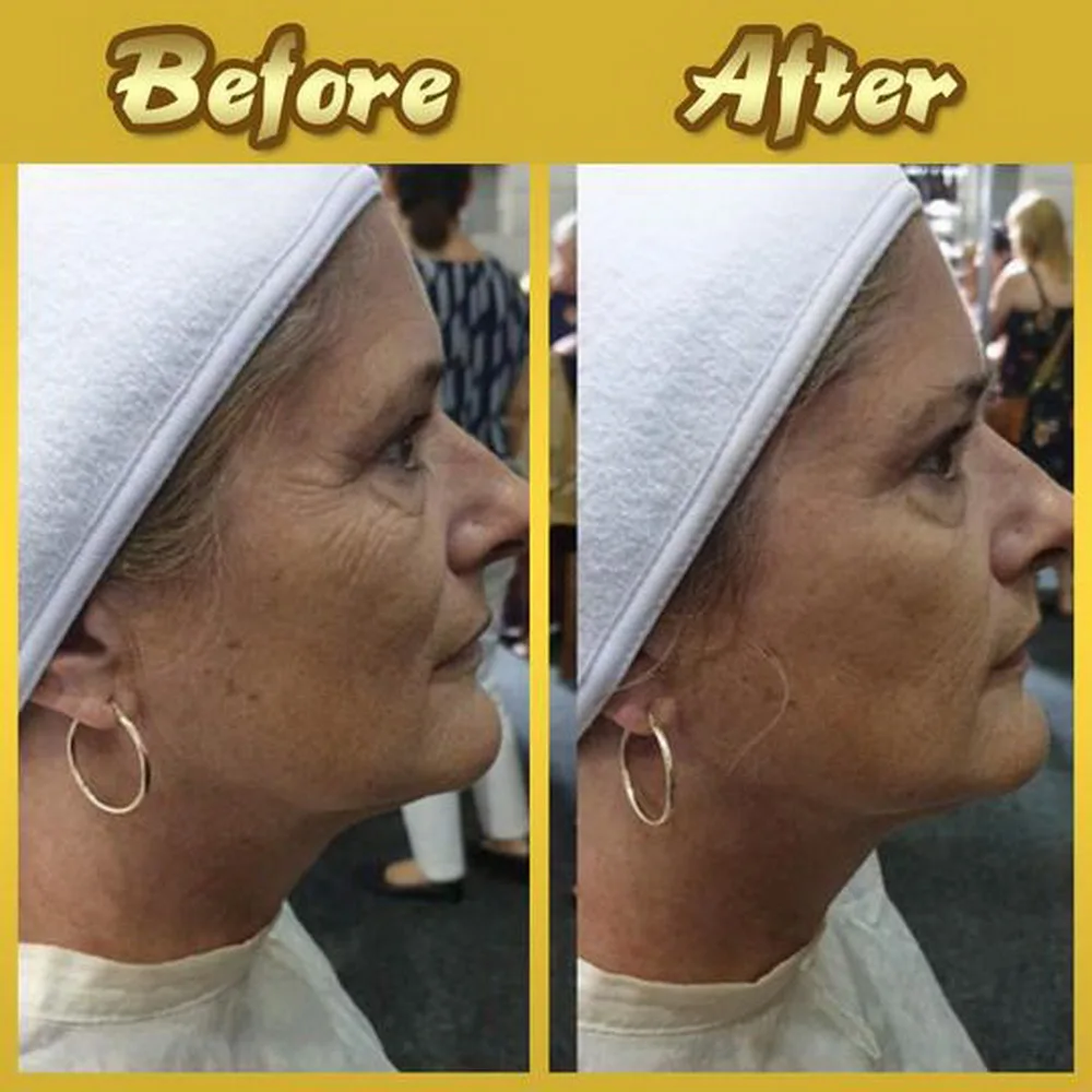 Отшелушивающая маска для лица отбеливающие маски против морщин Уход за кожей