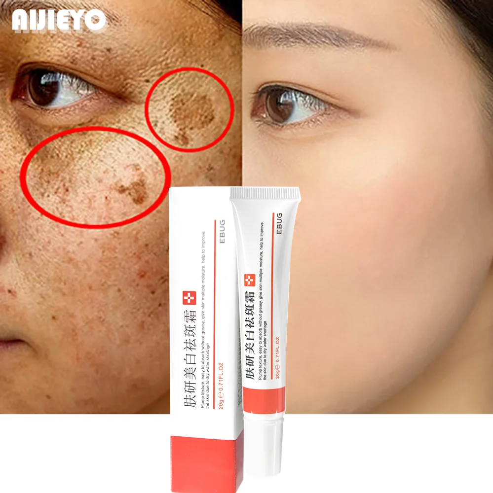 

Whitening Freckle Cream Remove Melasma Cream Remove Dark Spots Melanin Melasma Remover Brighten Skin Whitening
