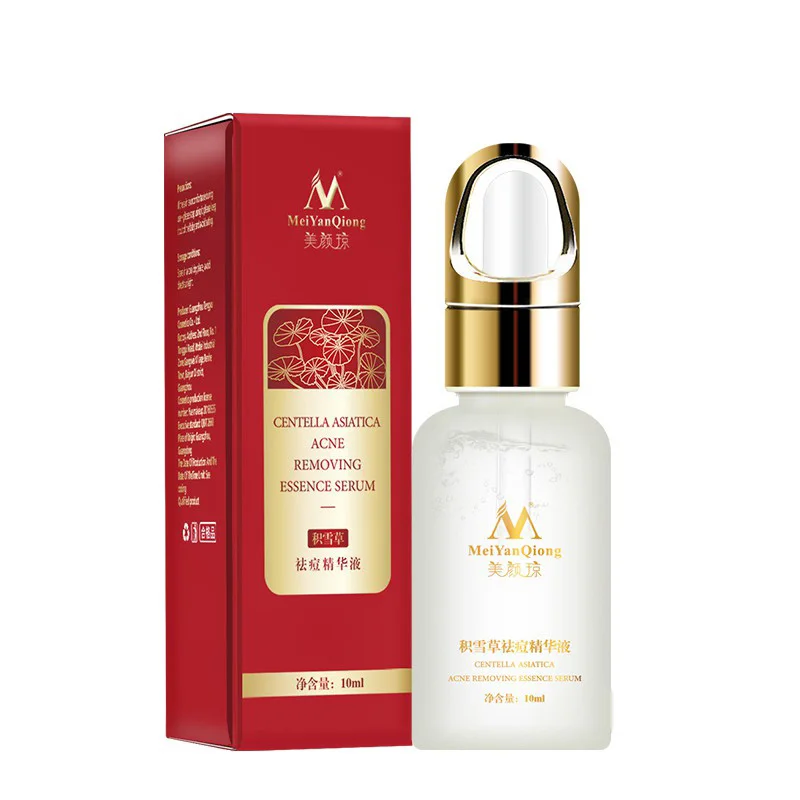 

Удаление акне удаление суть Сыворотки лечение для устранения акне Whiteng по уходу за кожей лица Сыворотки 10 мл