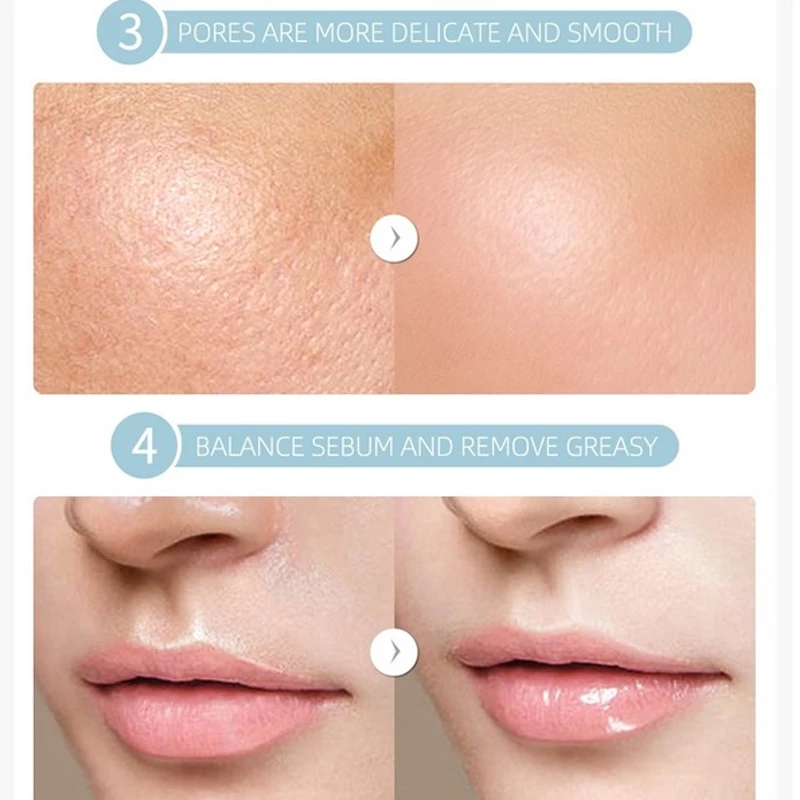 Сыворотка для лица жидкая розовая вода увлажняющий крем контроль жирности