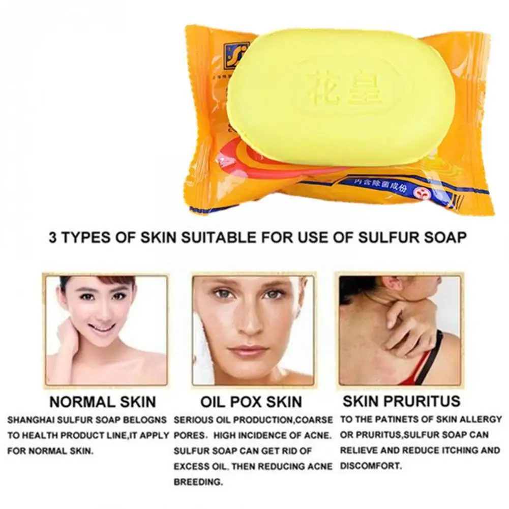 

Sulphur Soap Skin Care Dermatitis Fungus Eczema Anti Fungus Bath Bacteria Whitening Shower Soaps B1C9